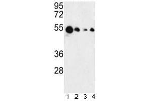 Western blot analysis of AIM2 antibody and 1) MCF-7, 2) HL-60, 3) K562 and 4) HeLa lysate.