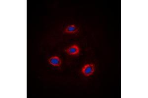 Immunofluorescent analysis of Alpha-adducin staining in HEK293 cells. (alpha Adducin anticorps  (C-Term))