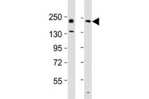 Western blot testing of Erbb2 antibody at 1:2000 dilution.