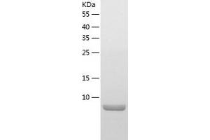 Western Blotting (WB) image for Lymphocyte Antigen 6 Complex, Locus E (LY6E) (AA 21-102) protein (His-IF2DI Tag) (ABIN7123800)