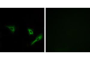Peptide - +Immunohistochemistry analysis of paraffin-embedded human breast carcinoma tissue using ATG4A antibody. (ATG4A anticorps)