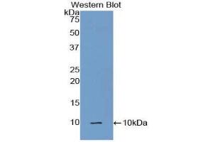 Western Blotting (WB) image for anti-Complement Component 5a (C5a) (AA 679-755) antibody (ABIN3208723) (C5A anticorps  (AA 679-755))