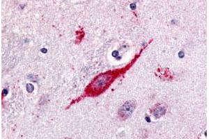 Immunohistochemical (Formalin/PFA-fixed paraffin-embedded sections) staining in human brain, neuron with GPR85 polyclonal antibody . (GPR85 anticorps  (C-Term))