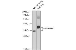 Western blot analysis of extracts of various cell lines, using ST3G antibody (ABIN6130192, ABIN6148529, ABIN6148531 and ABIN6217583) at 1:1000 dilution. (ST3GAL4 anticorps  (AA 27-267))