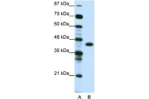 WB Suggested Anti-ZNF396 Antibody Titration:  0. (ZNF396 anticorps  (Middle Region))
