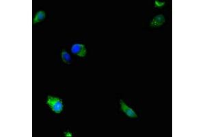 Immunofluorescence staining of Hela cells with ABIN7150717 at 1:233, counter-stained with DAPI. (MAP2K5 anticorps  (AA 1-190))