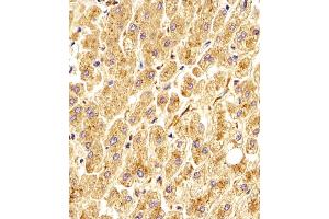 Antibody staining GAA in Human liver tissue sections by Immunohistochemistry (IHC-P - paraformaldehyde-fixed, paraffin-embedded sections).