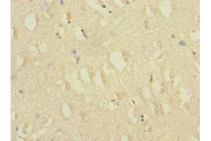 Immunohistochemistry of paraffin-embedded human brain tissue using ABIN7175576 at dilution of 1:100