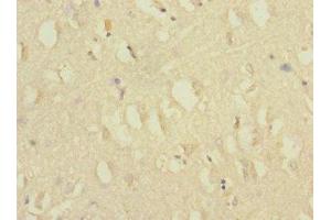 Immunohistochemistry of paraffin-embedded human brain tissue using ABIN7175576 at dilution of 1:100 (CACNG7 anticorps  (AA 156-275))
