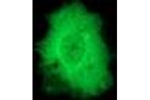 Image no. 3 for anti-Protein Phosphatase, Mg2+/Mn2+ Dependent, 1G (PPM1G) antibody (ABIN1500378)