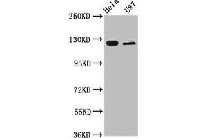 Western Blot Positive WB detected in: Hela whole cell lysate, U87 whole cell lysate All lanes: SLC4A5 antibody at 2. (NBC4 anticorps  (AA 1071-1137))