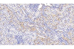 Detection of HbA1c in Human Kidney Tissue using Polyclonal Antibody to Glycated Hemoglobin A1c (HbA1c) (HbA1c anticorps)