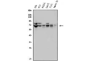 Western blot analysis of FRMD6 using anti-FRMD6 antibody (ABIN7599577). (FRMD6 anticorps  (AA 1-95))