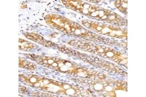 Immunohistochemistry analysis of paraffin-embedded rat small intestine using,INSR (ABIN7074298) at dilution of 1: 6000