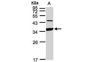 WB Image Sample(30 ug whole cell lysate) A:HeLa S3, 12% SDS PAGE antibody diluted at 1:1000 (ICAM2 anticorps)