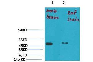 Western Blot (WB) analysis of 1) Mouse Brain Tissue, 2)Rat Brain Tissue with KV1. (Kv1.1 Potassium Channel anticorps)
