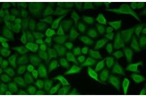 Immunofluorescence analysis of HeLa cells using CDC34 Polyclonal Antibody (CDC34 anticorps)