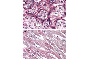 Immunohistochemical staining of formalin-fixed, paraffin-embedded human placenta (A) and human heart (B) tissue after heat-induced antigen retrieval. (EPHX2 anticorps  (C-Term))