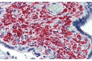 anti-delta-Like 1 Homolog (Drosophila) (DLK1) (AA 177-326) antibody