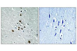 Immunohistochemical analysis of paraffin-embedded human brain tissue using SF1 (Phospho-Ser82) antibody (left)or the same antibody preincubated with blocking peptide (right).