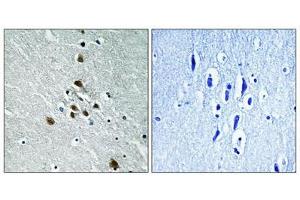 Immunohistochemical analysis of paraffin-embedded human brain tissue using SF1 (Phospho-Ser82) antibody (left)or the same antibody preincubated with blocking peptide (right). (Splicing Factor 1 anticorps  (pSer82))