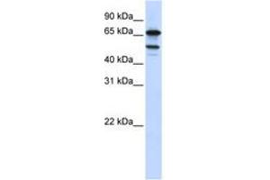 Image no. 1 for anti-Splicing Factor 4 (SF4) (AA 540-589) antibody (ABIN6740713) (Splicing Factor 4 anticorps  (AA 540-589))