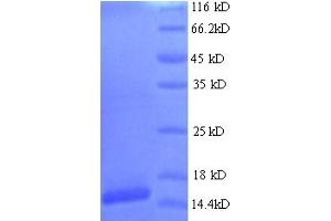 SDS-PAGE (SDS) image for Human Papilloma Virus 16 E7 (HPV-16 E7) (AA 1-105), (full length) protein (His tag) (ABIN5714208)
