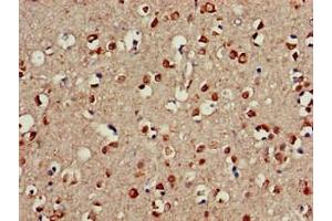 Immunohistochemistry of paraffin-embedded human brain tissue using ABIN7147214 at dilution of 1:100 (CDC42EP3 anticorps  (AA 1-226))