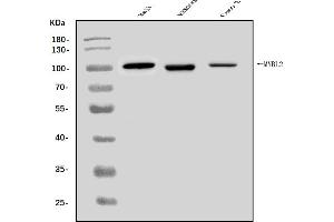 Western blot analysis of B MyB/MYBL2 using anti-B MyB/MYBL2 antibody (ABIN7601277).