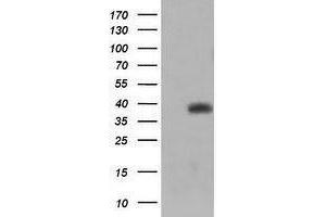 Image no. 8 for anti-Tripartite Motif Containing 44 (TRIM44) antibody (ABIN1501505) (TRIM44 anticorps)