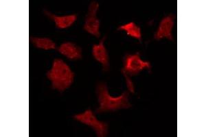 ABIN6269216 staining 293 by IF/ICC. (AKT1 anticorps)