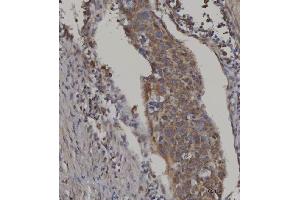 anti-Fatty Acid Transport Protein 3 (FATP3) (AA 192-683) antibody