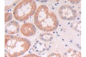 Detection of NCAM2 in Human Kidney Tissue using Polyclonal Antibody to Neural Cell Adhesion Molecule 2 (NCAM2)