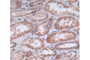 IHC-P analysis of Human Tissue, with DAB staining. (NG2 anticorps  (AA 559-776))