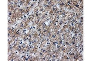 Immunohistochemical staining of paraffin-embedded liver tissue using anti-ANXA10mouse monoclonal antibody. (Annexin a10 anticorps)