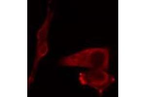 ABIN6269002 staining COLO205 cells by IF/ICC. (COL2A1 anticorps  (N-Term))