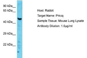 Host: Rabbit Target Name: Prkcq Sample Type: Mouse Lung lysates Antibody Dilution: 1. (PKC theta anticorps  (C-Term))