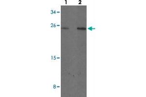 Western blot analysis of MYCT1 in rat lung tissue with MYCT1 polyclonal antibody  at (1) 1 and (2) 2 ug/mL.