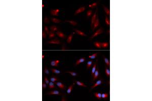 Immunofluorescence (IF) image for anti-ADAM Metallopeptidase Domain 9 (ADAM9) antibody (ABIN1876576)