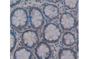 IHC-P analysis of Human Tissue, with DAB staining. (IL17F anticorps  (AA 31-163))