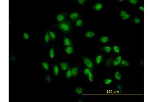 Immunofluorescence of monoclonal antibody to TULP2 on HeLa cell. (TULP2 anticorps  (AA 141-250))
