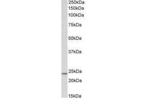 AP31709PU-N (0. (TIMP1 anticorps  (Internal Region))