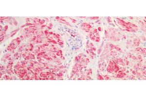 Detection of KLK4 in Human Prostate Tissue using Polyclonal Antibody to Kallikrein 4 (KLK4)