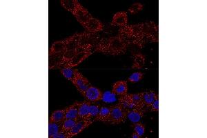 Confocal immunofluorescence analysis of A-431 cells using RPL21 antibody (ABIN7269996) at dilution of 1:100. (RPL21 anticorps  (AA 1-160))