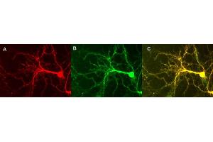 Indirect immunostaining of hippocampus neurons  (dilution 1 : 500)