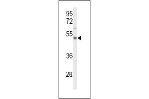 Western blot analysis of S39A8 Antibody (Center) (ABIN653308 and ABIN2842807) in CEM cell line lysates (35 μg/lane). (SLC39A8 anticorps  (AA 218-246))