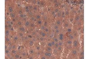 Detection of Hpt in Rat Liver Tissue using Polyclonal Antibody to Haptoglobin (Hpt)