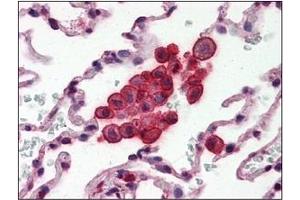 Immunohistochemistry (IHC) image for anti-Clusterin (CLU) (AA 1-333), (N-Term) antibody (ABIN317505) (Clusterin anticorps  (N-Term))