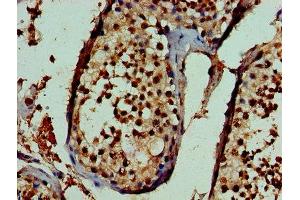 Immunohistochemistry of paraffin-embedded human testis tissue using ABIN7169424 at dilution of 1:100 (ASH2L anticorps  (AA 1-534))