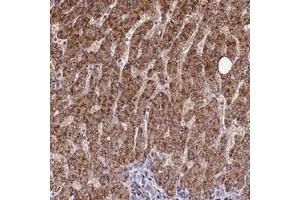 Immunohistochemical staining of human liver with FAM186B polyclonal antibody  shows strong cytoplasmic positivity in hepatocytes at 1:50-1:200 dilution. (FAM186B anticorps)